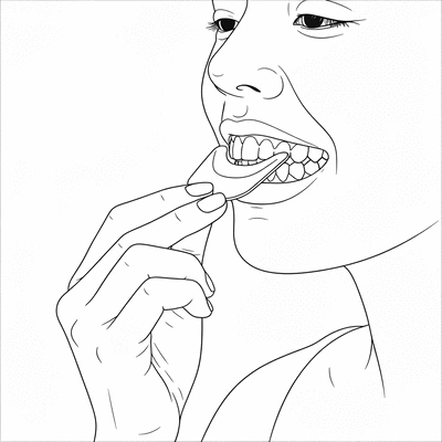 Person applying an at-home teeth whitening strip, close up on mouth, clean bathroom background, no text, no words